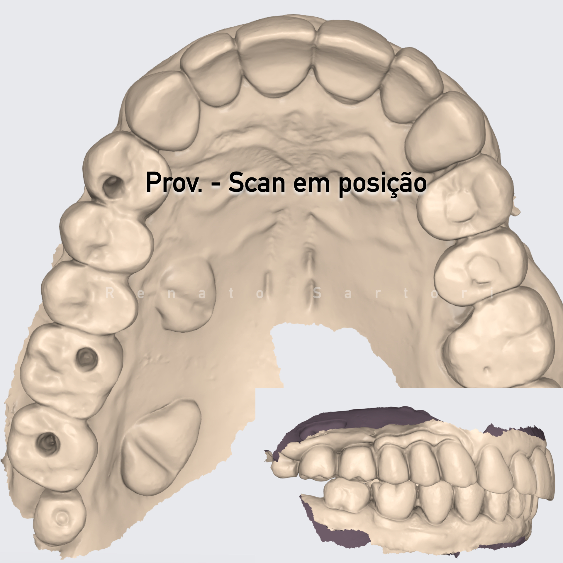 Post.002
